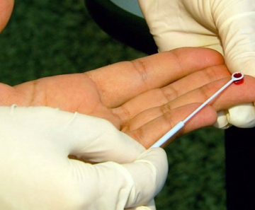 Exame rápido detecta o vírus HIV com uma única gota de sangue 