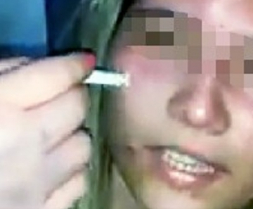 Garota apaga cigarro no rosto de 'rival' por causa de namorado 