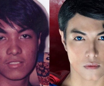 Antes e depois: o filipino Herbert Chavez, de 37 anos, fez 23 plásticas para ficar parecido com o Super-Homem 
