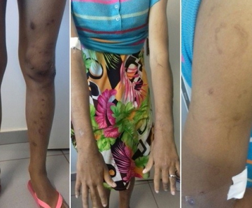 Adolescente foi torturada por mais de um ano em Santa Helena de Goiás 