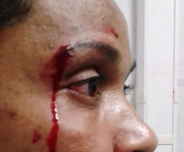 Enfermeira foi agredida por mulher de paciente no Pronto-Socorro de Cuiabá