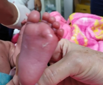 Bebê de 6 meses jogado em poço pelos pais era vítima de maus tratos em MT