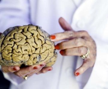 Cientistas concluem que lítio reverte males de radiação no cérebro - Foto: Divulgação