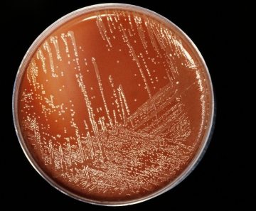 Bactéria da meningite