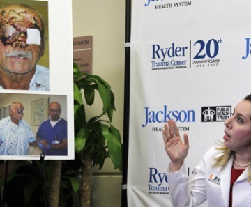 A cirurgiã plástica Wrood Kassira, do Jackson Memorial Hospital, exibe imagens de Ronald Poppo, que teve rosto devorado por ataque canibal, durante entrevista em 12 de junho 