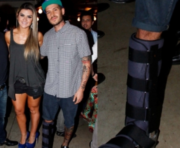 Mateus Verdelho deixa baixo-astral de lado e vai curtir com o pé quebrado 