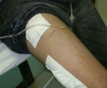 Após atirar contra a própria perna, o suspeito foi por conta própria para o hospital 