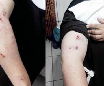 Freiras tiveram ferimentos depois de serem atacadas por cão de guarda, em Juína.