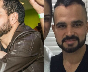 Luciano Camargo, antes de passar pelo procedimento e minutos antes de encarar o implante 