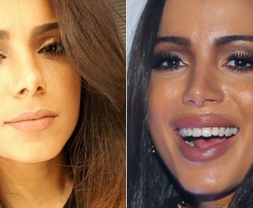 Anitta 