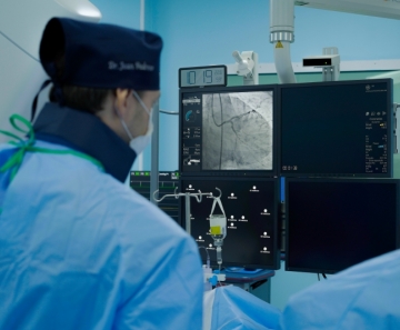 angioplastia