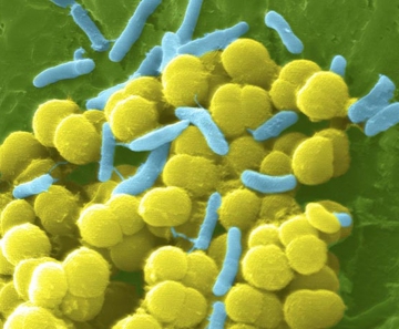 Grupo de `Staphylococcus aureus` é vista por microscopia eletrônica