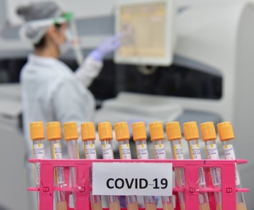Coronavírus em esgoto de 5 países antes de surto na China aumenta mistério sobre origem do vírus