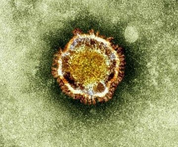 Covid-19 é a doença ou o vírus? Existe Sars-Cov-1 e Sars-Cov-2? Quarentena ou isolamento? G1 traduz principais termos usados pelos especialistas.