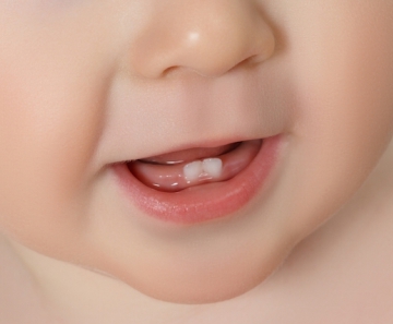 dentes_do_bebe_18411_l