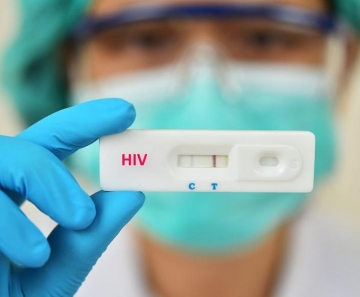 teste_hiv_n